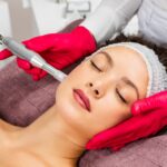 Eine Frau beim Microneedling